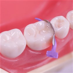 FENDERMATE TEMP 18 PACK