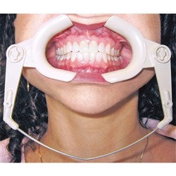 High Heat Cheek Retractor 1 Per Pk