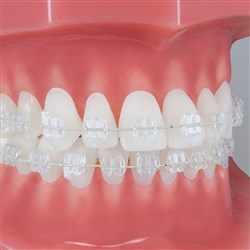 Pure MBT 11R Torq +17 Ang +4 Width .126 Inch