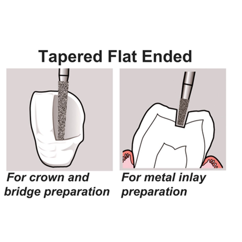 DIAMOND POINT FG REG 103
