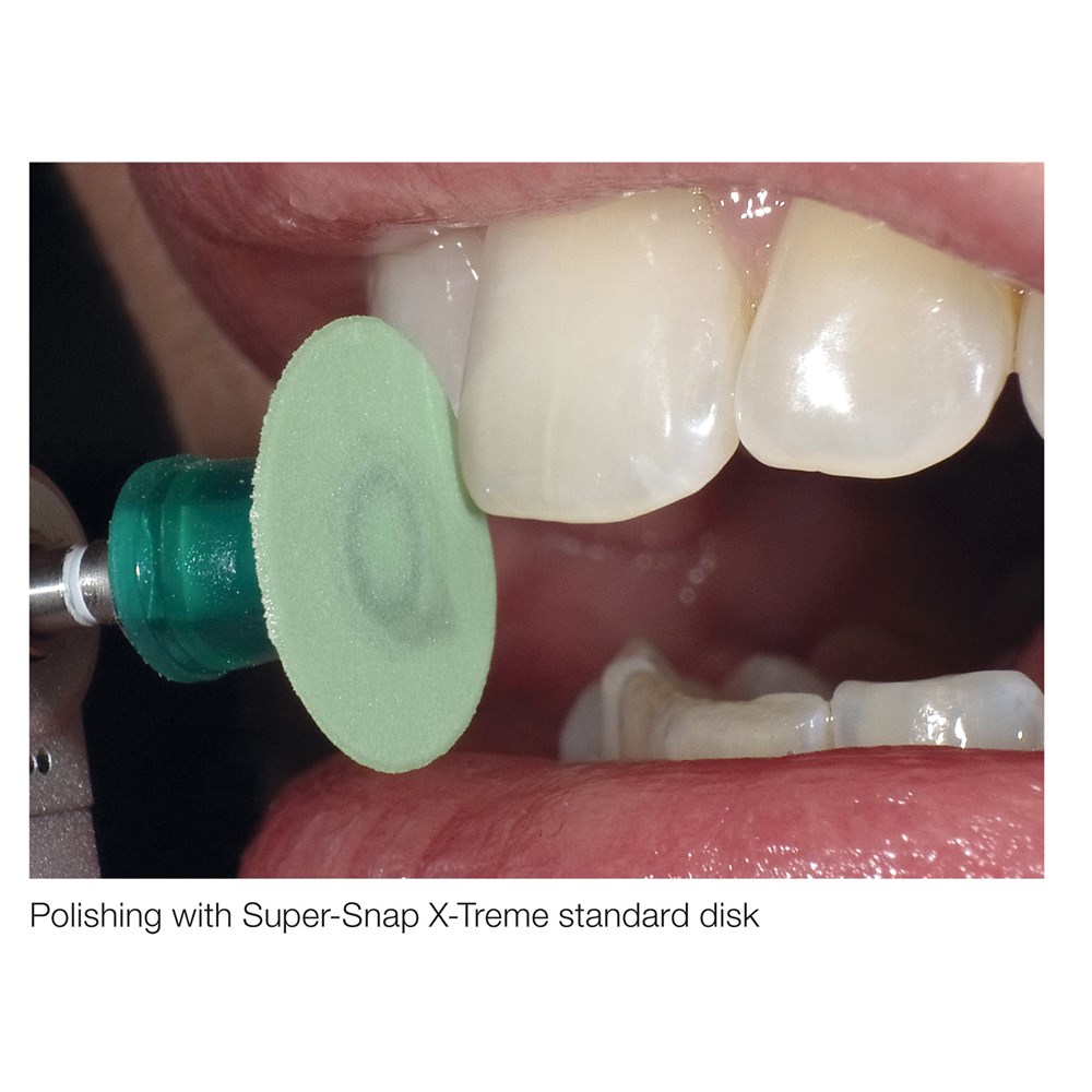 SUPER-SNAP X-TREME FINE MINI GREEN  DOUBLE SIDED 50 PACK